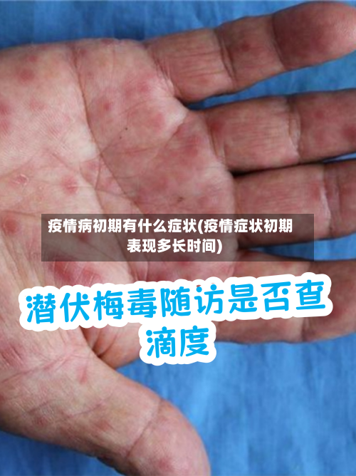 疫情病初期有什么症状(疫情症状初期表现多长时间)